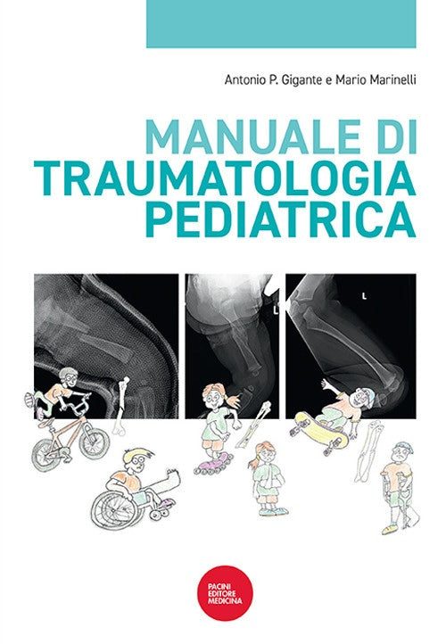 Manuale di traumatologia pediatrica - Gigante